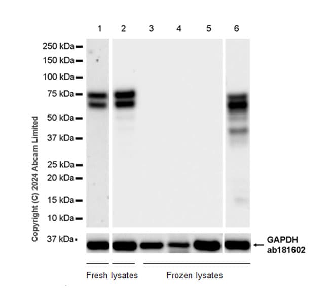 Anti-TOX antibody [EPR28108-10](ab322259)