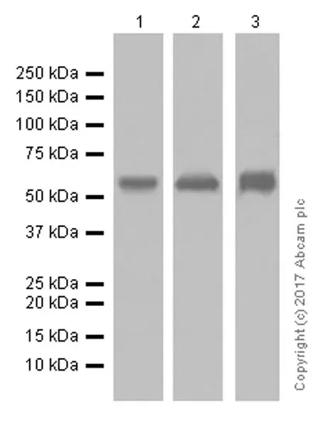 Anti-Cytokeratin 5 antibody [EP1601Y] - Cytoskeleton Marker(AB52635)