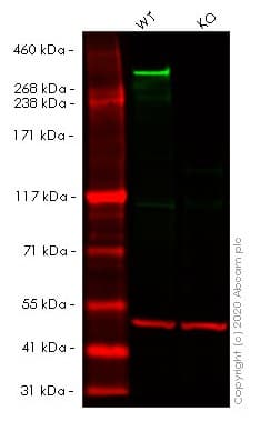 Anti-Huntingtin antibody [EP867Y](AB45169)