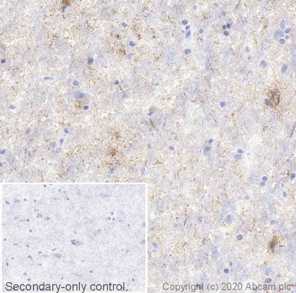 Anti-Tau (phospho S396) antibody [E178](ab32057)