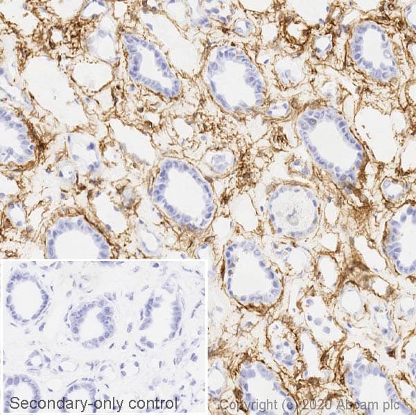 Anti-PDGFR alpha antibody [EPR22059-270](AB203491)