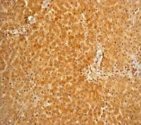Vitamin D Binding Protein Antibody Ep2923y Ab81307  Immunohistochemistry Formalin Pfa Fixed Paraffin Embedded Sections Img86635