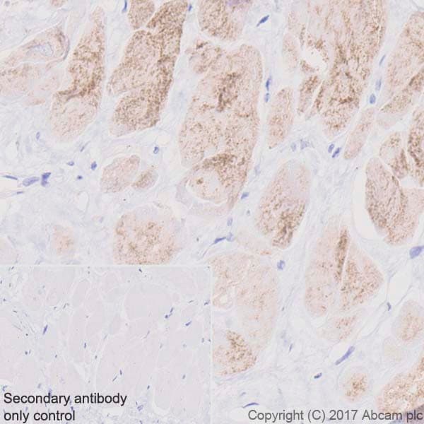 Anti-Hexokinase II antibody [EPR20839](AB209847)