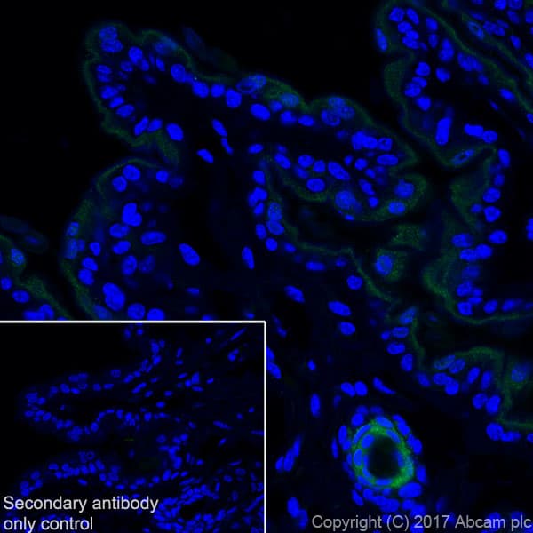 Gsdma Antibody Epr19858 17 Ab214818  Immunohistochemistry Frozen Sections Img120970