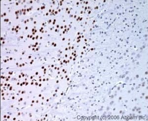 Anti-FOXP1 antibody(AB16645)