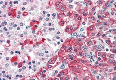 Anti-TMPRSS4 antibody(AB188816)