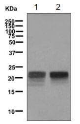 Fsh Beta Antibody Epr7930 Ab150425  Western Blot Img61779