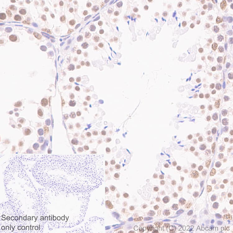 Hnrnp H Antibody Epr25302 12 Bsa And Azide Free Ab289999  Immunohistochemistry Formalin Pfa Fixed Paraffin Embedded Sections Img178775