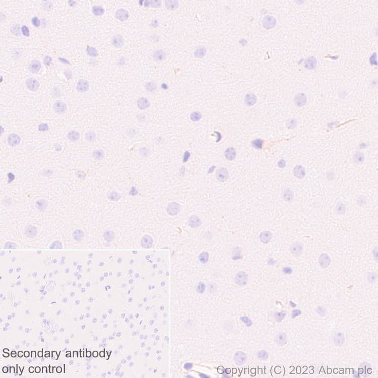Fyco1 Antibody Epr28361 79 Bsa And Azide Free Ab316013  Immunohistochemistry Formalin Pfa Fixed Paraffin Embedded Sections Img426125