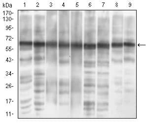 Eif2a Antibody 3a7b11 Ab181467  Western Blot Img103761