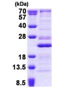Recombinant Human RPL26 protein(AB167904)