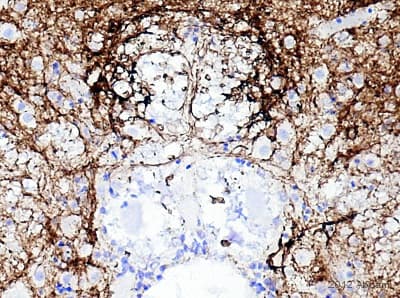 Anti-PGP9.5 antibody [13C4 / I3C4](AB8189)