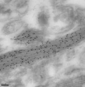 Anti-GFAP antibody [6F2](ab8975)