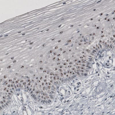 Anti-NIFK antibody [CL2240] - Nucleolar Marker(AB211871)