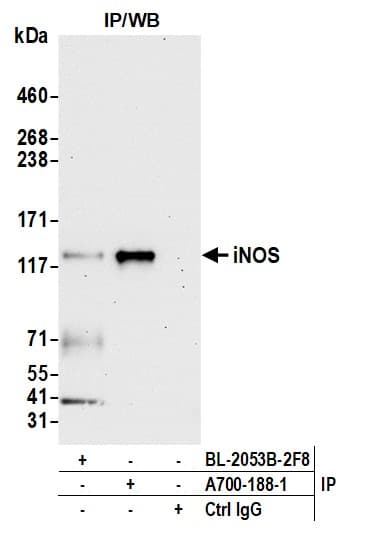 Inos Antibody Blr188j Bsa Free Ab314088  Immunoprecipitation Img420589