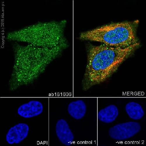 Exosome Panel (Calnexin, CD9, CD63, CD81, Hsp70, TSG101)(AB275018)