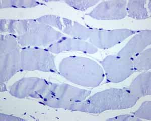 Anti-FOXP1 antibody [EPR4113](AB134055)