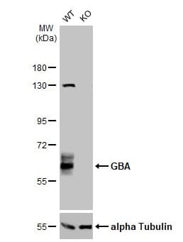 Anti-GBA antibody(AB96256)