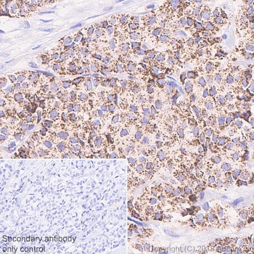 Abat Gaba T Antibody Epr20842 Bsa And Azide Free Ab233702  Immunohistochemistry Formalin Pfa Fixed Paraffin Embedded Sections Img121743