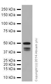 Anti-Cytokeratin 7 antibody [EPR17078] - Cytoskeleton Marker(AB181598)