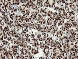Samhd1 Antibody Oti1a1 Ab128107  Immunohistochemistry Formalin Pfa Fixed Paraffin Embedded Sections Img128778