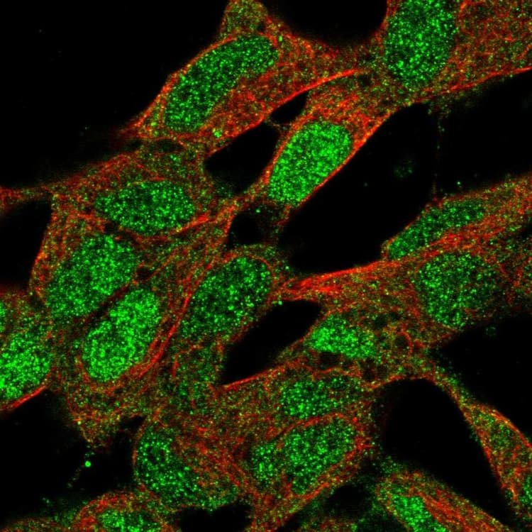 Cnbp Antibody Ab272676  Immunocytochemistry Immunofluorescence Img45671