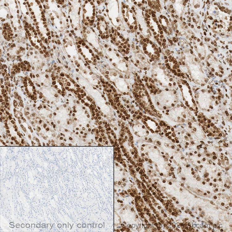 Anti-CPT1A antibody [8F6AE9](AB128568)