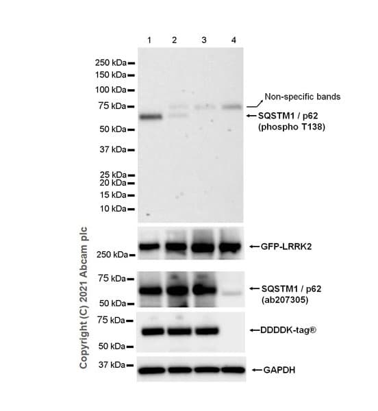 Anti-SQSTM1 / p62 (phospho T138) antibody [MJF-R44-20] - BSA and Azide free(AB285172)