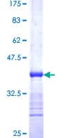 Ab157846  Sds Page Img142385