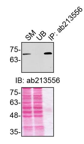 Optineurin Antibody Epr20654 Ab213556  Immunoprecipitation Img180442