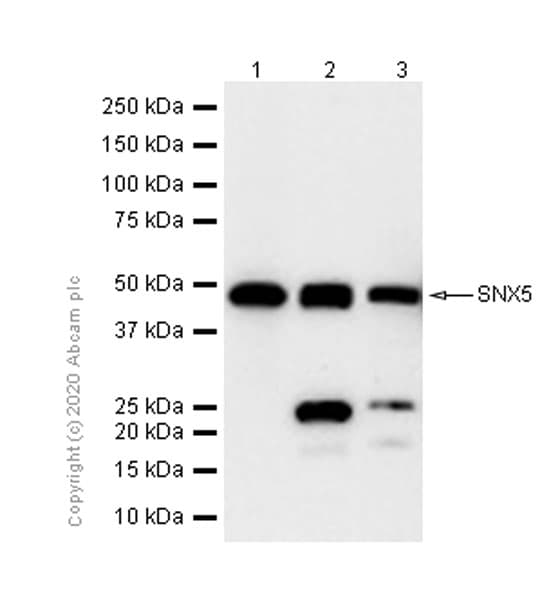 Snx5 Antibody Epr14358 Bsa And Azide Free Ab250218  Western Blot Img175886