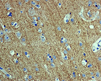 Snap25 Antibody Ep3274 Ab108990  Immunohistochemistry Formalin Pfa Fixed Paraffin Embedded Sections Img138757