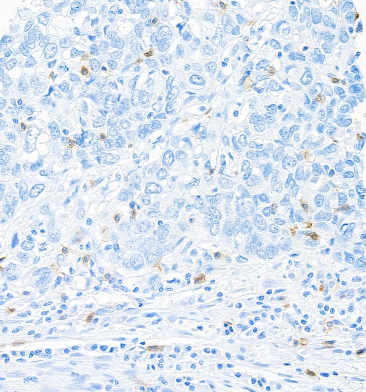 Anti-CD103/ITGAE antibody [BLR171J] - BSA free(AB314101)