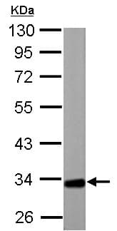 Etfa Antibody Ab153722  Western Blot Img144121
