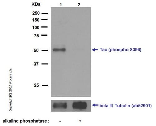 Anti-Tau (phospho S396) antibody [EPR2731](AB109390)