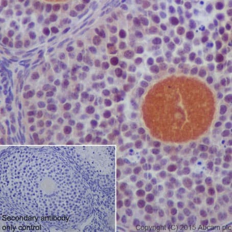 Dcaf13 Antibody Epr18723 Bsa And Azide Free Ab240337  Immunohistochemistry Formalin Pfa Fixed Paraffin Embedded Sections Img25262