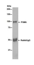 Anti-PSMA antibody [EPR6253] - BSA and Azide free(AB226141)
