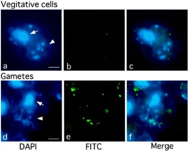 Anti-5-methylcytosine (5-mC) antibody [5MC-CD](AB73938)