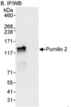 Anti-Pumilio 2 antibody(AB10361)