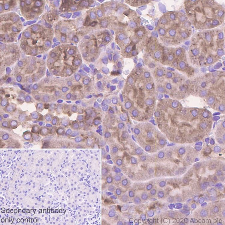 Snx5 Antibody Epr14358 Bsa And Azide Free Ab250218  Immunohistochemistry Formalin Pfa Fixed Paraffin Embedded Sections Img168271