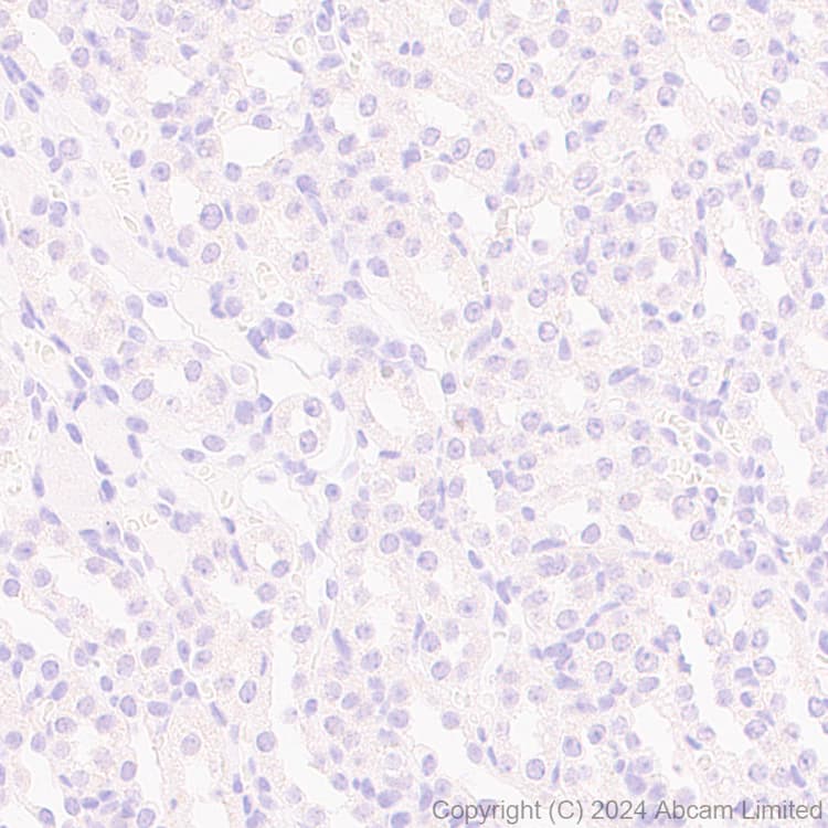 Anti-MASH1/Achaete-scute homolog 1 antibody [EPR19840](AB211327)