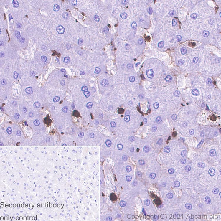 S100 Alpha 6 Pra Antibody Epr13084 69 Bsa And Azide Free Ab250543  Immunohistochemistry Formalin Pfa Fixed Paraffin Embedded Sections Img175321