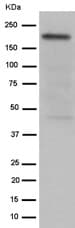 Slit1 Slit2 Antibody Ep5796n Bsa And Azide Free Ab284838  Western Blot Img81737