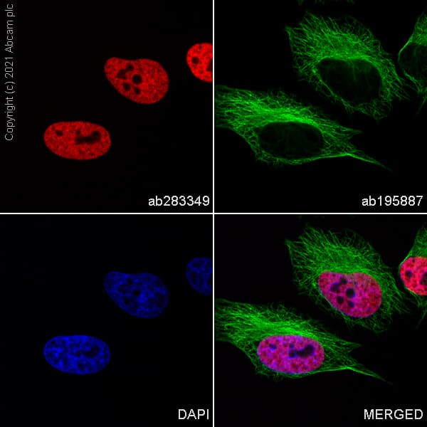 Alexa Fluor® 647 Anti-Histone H3 (mono methyl K4) antibody [ERP16597](AB283349)