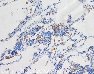 Anti-LAMP1 antibody [1D4B](AB25245)