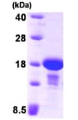 Ab92932  Sds Page Img46594