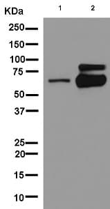 Anti-Choline Acetyltransferase antibody [EPR13024(B)](AB181023)