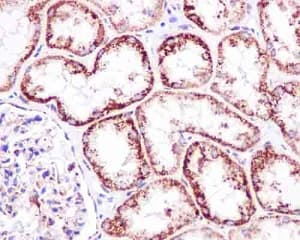Ndufab1 Antibody Epr6725 Bsa And Azide Free Ab250289  Immunohistochemistry Formalin Pfa Fixed Paraffin Embedded Sections Img71677