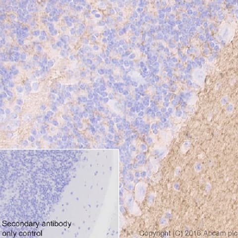 Anti-Tenascin C antibody [EPR4219](AB108930)