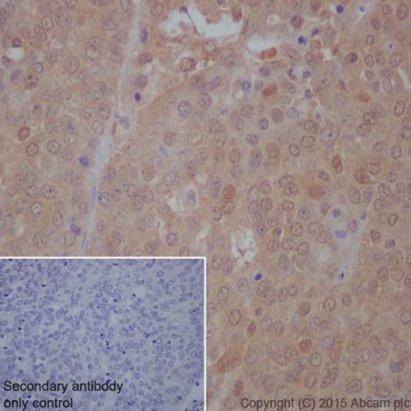 Anti-mTOR (phospho S2448) antibody [EPR426(2)](AB109268)